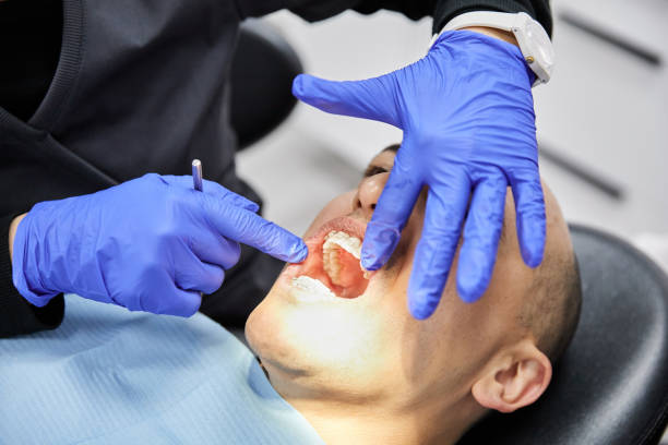Best Knocked-Out Tooth (Avulsed Tooth) Treatment in Lake City, GA