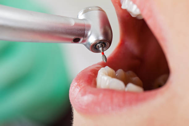 Best Emergency Treatment for Jaw Pain or Injury in Lake City, GA
